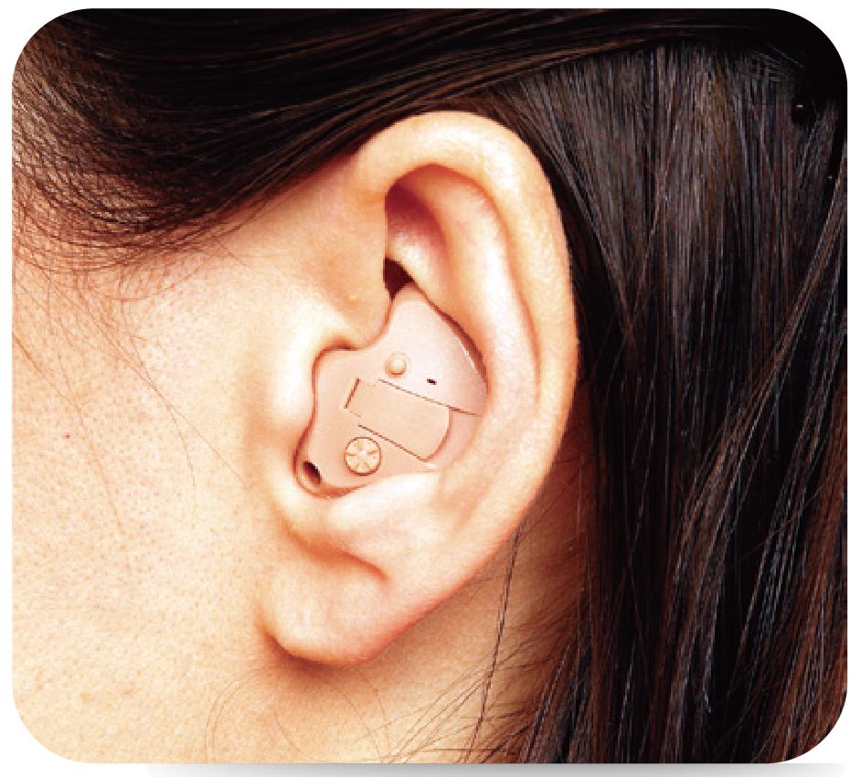 助听器的种类依外观区分